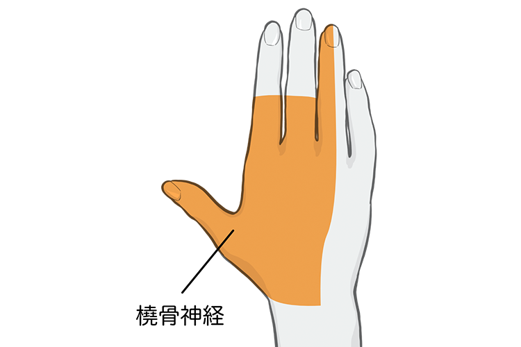 橈骨神経麻痺画像