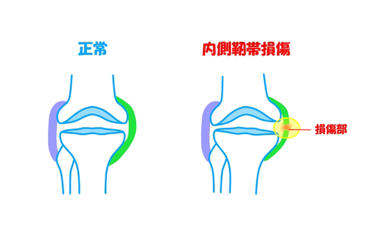 ジャンパー膝画像