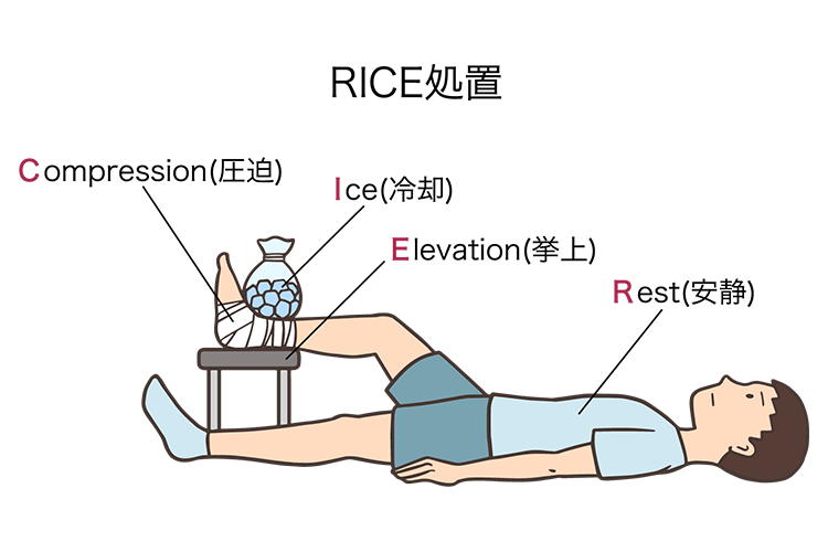 RICE処置