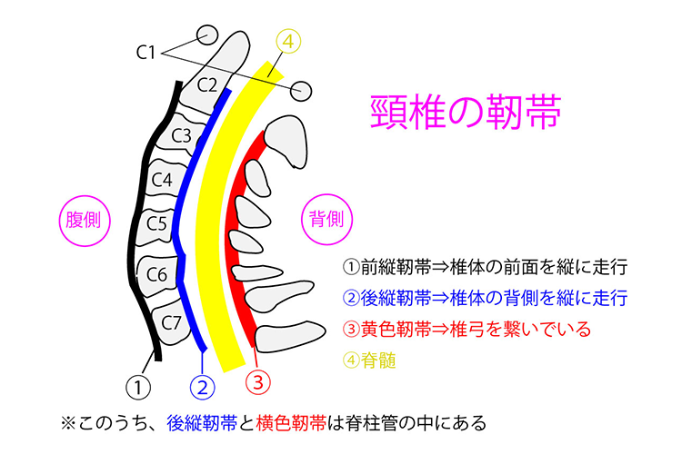 頸椎後縦靭帯骨化症画像